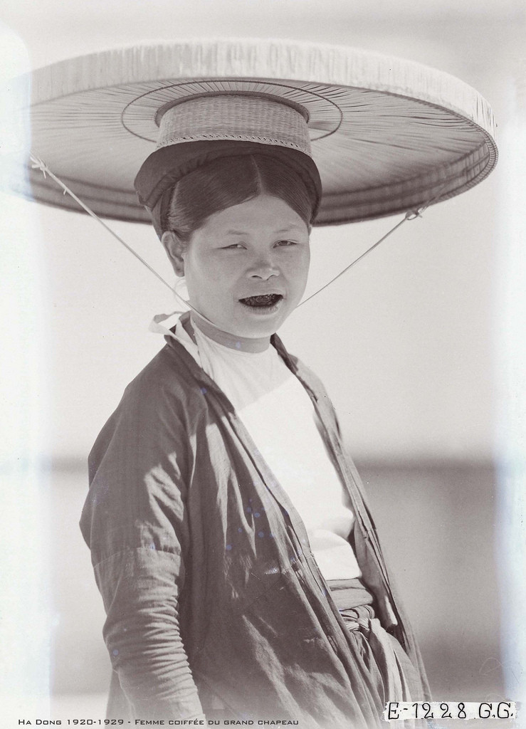 Bên cạnh yếu tố thẩm mỹ, việc nhuộm răng cũng là một cách để bảo vệ răng trước những bệnh răng miệng thường gặp, điển hình là bệnh sâu răng.