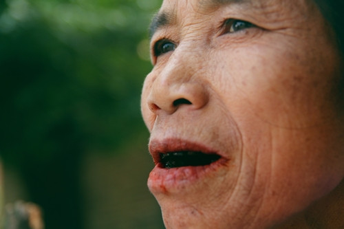 Vào đầu thế kỷ 20, khi thực dân Pháp đến nước ta, phong tục nhuộm răng đen ngày càng mai một. Ngày nay, hiếm gặp những thiếu nữ răng đen trên đường phố, có chăng là những cụ già ở vùng Bắc Bộ hoặc phụ nữ các dân tộc ít người.