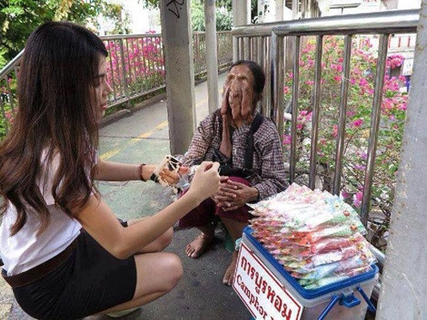 Mặc dù bị căn bệnh quái ác hành hạ từ nhỏ, nhưng cụ bà TaKet (người Thái Lan) vẫn luôn mạnh mẽ, có niềm tin vào cuộc sống, khiến hàng triệu người cảm động.