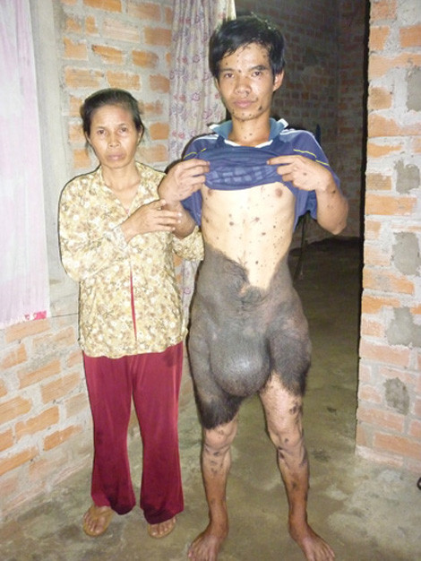 Đào Văn Đông bên cạnh mẹ của mình. (Ảnh T.K.Anh)