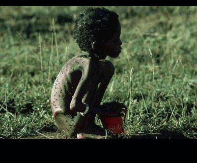 Bức ảnh có tên "Kền kền đợi chờ", cho người xem thấy được cuộc sống đói nghèo mà trẻ em ở Châu Phi đang phải gánh chịu. Sức sống mỏng manh và cơ thể chỉ còn mỗi "da bọc xương" của em bé trong ảnh như xoáy thẳng vào tâm trí người xem, khiến họ không kìm được nước mắt.