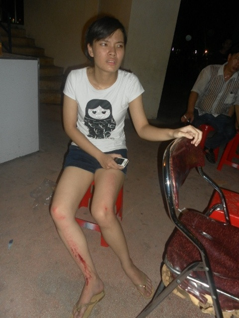 Con chị Nguyễn Thị Tuyết bị thương ở chân.