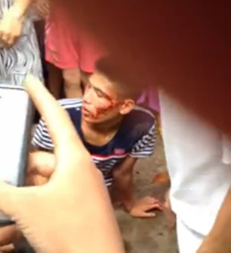 Nam thanh niên bị người dân vây đánh chảy cả máu mặt...