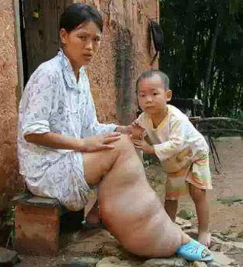 "Dù mẹ có thế nào? Con vẫn luôn kề bên"