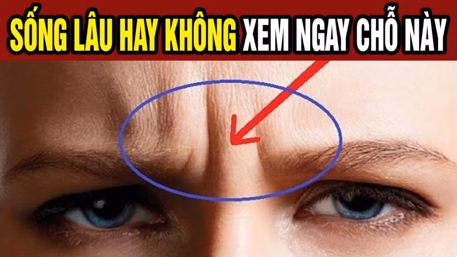 Dan ong suc khoe kem, kho thanh cong... thuong so huu 3 net tuong nay-Hinh-2