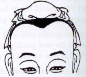 Vầng trán như hình trên tạo thành hình chữ M. Đây được gọi là vầng trán của nghệ sĩ. Những người có trán này có khả năng sáng tạo cao, vì thế, họ có thể thành công trong nhiều ngành nghề. Tuy nhiên, họ hơi bảo thủ, cố chấp vì thế không phải lúc nào họ cũng đạt được thành công. Nếu trán chữ M kết hợp thêm phần xương trán gồ lên nổi rõ thì sẽ đạt thành tựu lớn trong sự nghiệp, ngược lại thì mọi việc chỉ đạt ở mức độ bình thường.