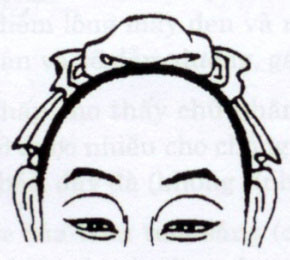 Trán như hình trên là trán có hình vòng cung, đây là dạng trán tiêu chuẩn dành cho nữ giới. Những người có trán này thường dịu dàng, thông minh, hiểu lòng người, biết cách cư xử. Nam giới có trán này tính tình sẽ lương thiện, hiền lành nhưng không có chí tiến thủ và thiếu khả năng sáng tạo.