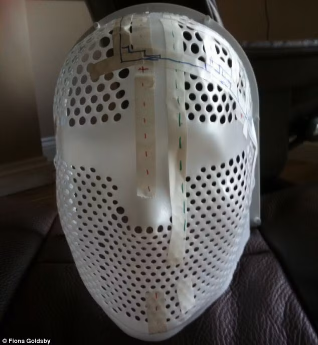 Sau khi phẫu thuật thành công, Goldsby tiếp tục được xạ trị. Cô nói rằng cô phải đeo một cái mặt nạ "khủng khiếp" (ảnh) khiến cô ấy cảm thấy ngột ngạt và ghê sợ. Sau này, cô đã sử dụng nó như là một vật trang trí vào dịp lễ Halloween.