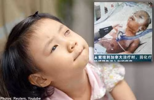 Gia đình cô bé Zixuan đã bỏ ra hơn 200.000 USD cho việc điều trị của con gái song hai mắt của cô bé vẫn bị mù lòa vĩnh viễn.