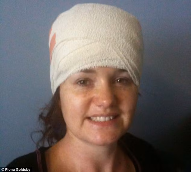 Goldsby đã được cho phép về nhà sau khi được phẫu thuật và tĩnh dưỡng 4 ngày trong bệnh viện.