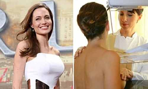 Những phụ nữ có tiền sử gia đình bị ung thư vú như nữ diễn viên nổi tiếng Angelina Jolie (trái) nên tầm soát di truyền bằng cách xét nghiệm máu để sớm phát hiện và có biện pháp điều trị.