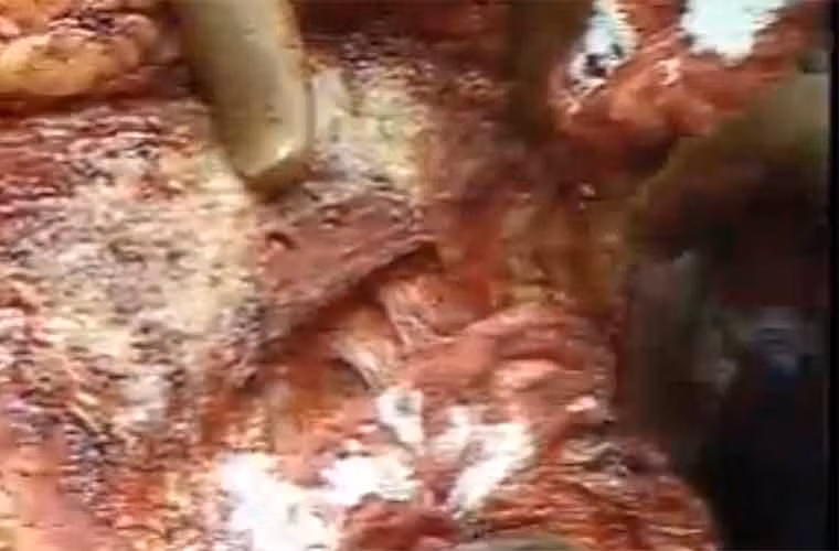 ...bắt đầu dò tìm khối u...