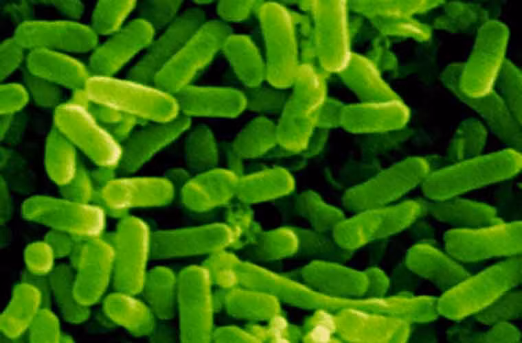 Vi khuẩn Escherichia coli (E. coli).