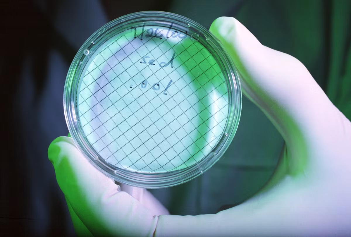 9. Đồng USD có rất nhiều vi khuẩn. Trong một nghiên cứu được thực hiện bởi ĐH Ballarat (Australia), các nhà khoa học đã lấy mẫu từ 1.200 tờ USD trên khắp thế giới. Họ phát hiện tại Mỹ, tờ USD sạch nhất chứa 20 con vi khuẩn, còn tờ bẩn nhất có tới 25.000 con. Dù phần lớn vi khuẩn trên các tờ tiền là vô hại nhưng các nhà khoa học vẫn khuyên mọi người nên rửa tay kỹ sau khi tiếp xúc với tiền.