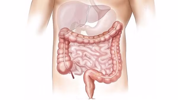 3 thuc uong buoi sang giup thai sach duong ruot