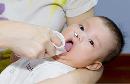 Nhiễm trùng. Bé có thể mắc bệnh răng miệng hoặc nhiễm trùng tuyến nước bọt khiến nước dãi chảy nhiều hơn.