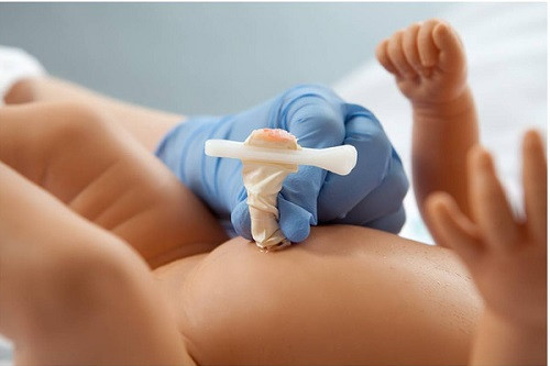 Sai lầm mà các bậc phụ huynh thường mắc phải khi chăm sóc rốn cho trẻ là: không dám đụng vào rốn của trẻ, chờ đến khi trẻ rụng rốn mới đụng đến kéo dài 2-3 tháng mới mở ra... Thói quen này đã ảnh hưởng không tốt đến sức khỏe của trẻ.