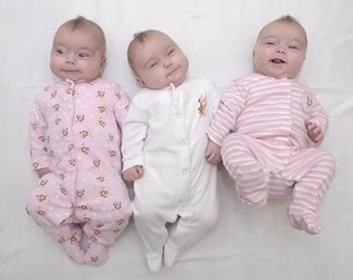 Đa thai cùng trứng: Là hiện tượng trứng sau khi được thụ tinh, tách làm đôi trong giai đoạn hợp tử rồi phát triển thành 2 hoặc nhiều phôi. Hai hoặc nhiều cá thể khi phát triển sẽ giống nhau về hình thức, gene và kháng nguyên.