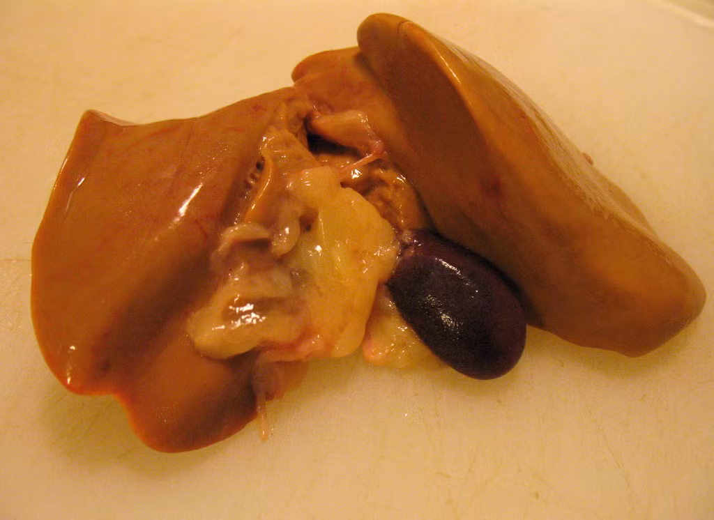 Gan gà hầm nhục quế: Gan gà 1-2 cái, nhục quế 2g, nước vừa đủ. Tất cả cho vào bát to hầm cách thủy. Ăn gan, uống nước. Tác dụng: Ôn thận tán hàn, trị tiểu dầm, tiểu đêm nhiều lần.