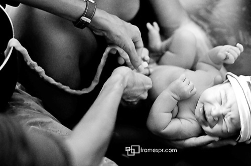 Việc chậm cắt dây rốn cho bé sơ sinh sẽ giúp các tế bào quan trọng được truyền từ mẹ sang bé đầy đủ và khỏe mạnh.