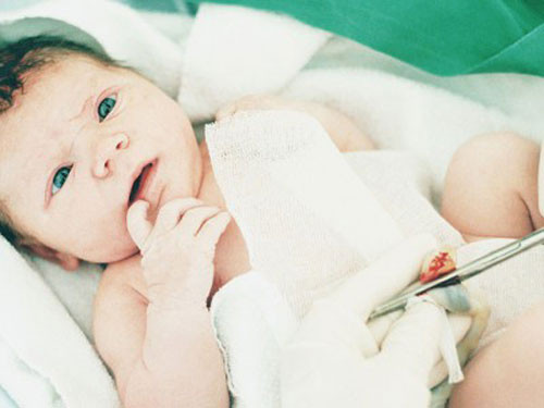 Ở một số nước phương Tây, bố mẹ có thể được tự tay cắt dây rốn cho bé dưới sự hướng dẫn của bác sĩ khi dây rốn đã được kẹp.