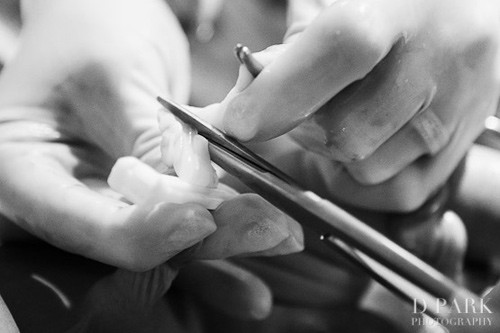 Trong khi đó, ở các bệnh viện, phương pháp chủ yếu là bác sĩ sẽ cắt dây rốn cho bé. Các nhà nghiên cứu chỉ ra rằng sau khi lọt lòng mẹ, các bác sĩ nên chờ vài phút rồi hãy cắt dây rốn cho bé.