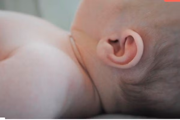 Một số chuyên gia khuyên bạn nên nhỏ một vài giọt sữa mẹ vào tai trẻ sẽ giúp đẩy lùi việc nhiễm trùng tai. Đơn giản chỉ cần nhỏ vào tai bé trong khoảng một vài giờ. Sữa mẹ sẽ giúp tai bé khỏi nhiễm trùng nhanh hơn các loại thuốc truyền thống và đương nhiên là nó rẻ hơn nhiều.