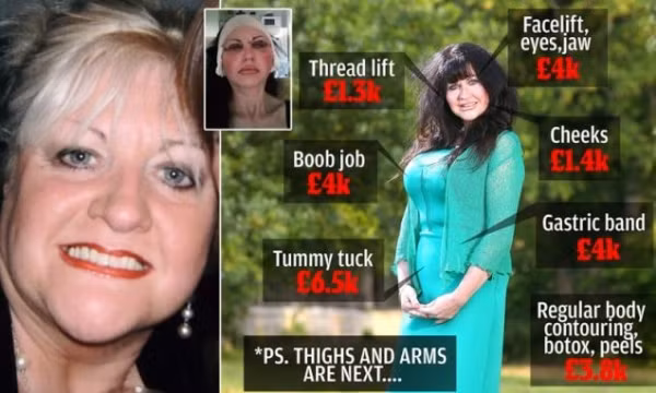 Hầu như tất cả các bộ phận trên cơ thể cô đều đã đụng đến dao kéo.