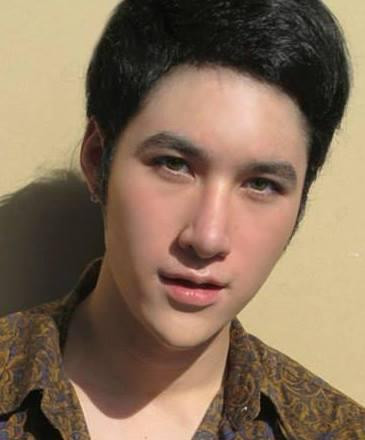 Chàng trai này cũng đưa ra lời khuyên với những ai có ý định làm đẹp với deo kéo: "Quá trình phẫu thuật không thể tránh khỏi đau đớn và rủi ro, vì thế hãy suy nghĩ thận trọng".