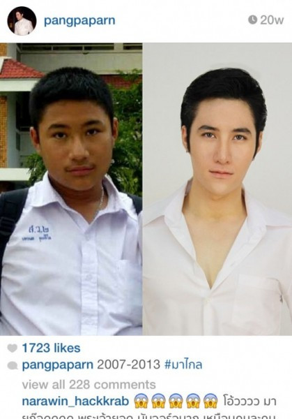 Chàng trai người Thái Pan Pang tự tin khoe ảnh năm 2007 và sau khi phẫu thuật thẩm mỹ năm 2013.