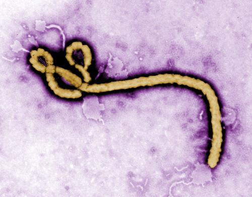 Cấu trúc của virus gây dịch Ebola được hiển thị trên máy tính điện tử.
