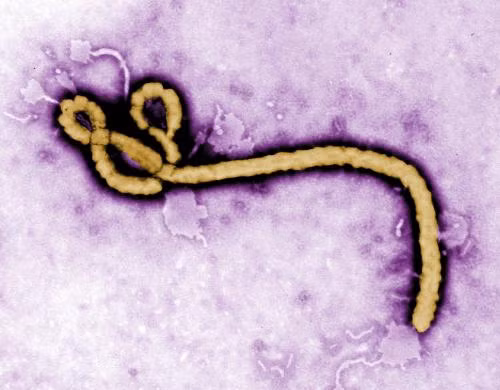 Cấu trúc của virus gây dịch Ebola được hiển thị trên máy tính điện tử.