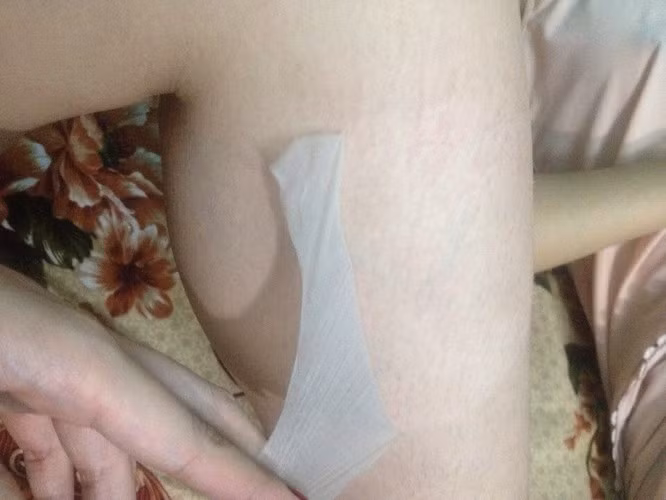 Các loại kem trên thị trường thường chứa các chất độc hại với cơ thể nhưng lại làm trắng rất nhanh. Bản chất của các loại kem tẩy trắng da, kem lột da đều chứa những loại hóa chất tẩy. Những chất tẩy này khi được thoa lên da sẽ tẩy, làm bong tróc lớp biểu bì trên da, để lại phần da non phía trong, do vậy gây nên ảo giác cho người sử dụng về công dụng làm trắng của nó. Tùy từng loại sản phẩm sẽ có liều lượng tẩy khác nhau, do đó sẽ có độ tẩy trắng khác nhau.