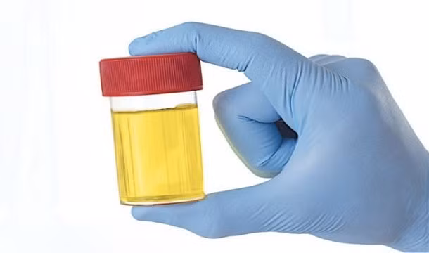 Súc miệng nước tiểu làm trắng răng. Người La Mã cổ đại quan niệm nước tiểu có chứa ammonia là loại nước súc miệng hoàn hảo, có khả năng khử trùng, ngăn ngừa sâu răng và làm răng trắng tự nhiên. Tuy nhiên, bạn có thể bị nhiễm trùng do vi khuẩn và mùi hôi miệng do nước tiểu.