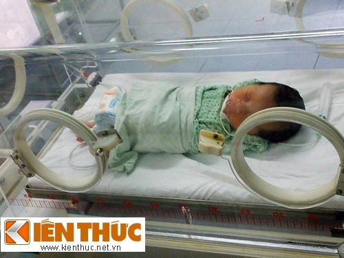 Tình trạng của sản phụ là do tắc mạch ối, đây là biến chứng bất ngờ và nguy hiểm. Tắc mạch ối không thể chẩn đoán hay dự liệu trước được dù ở cả những nước tiên tiến như Mỹ, Anh, Nhật...