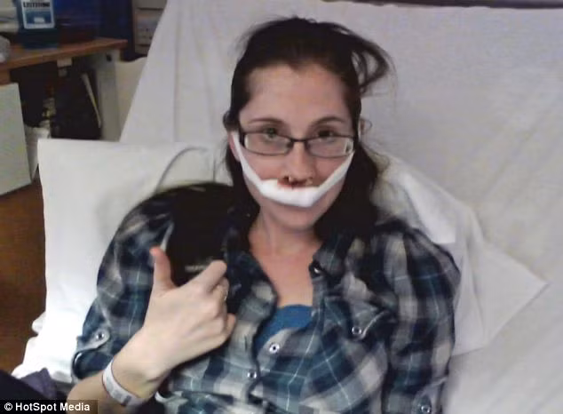 Năm 2011 cô đã trải qua ca phẫu thuật cắt bỏ khối u này nhưng nó đã bắt đầu phát triển trở lại vào tháng Giêng năm nay.