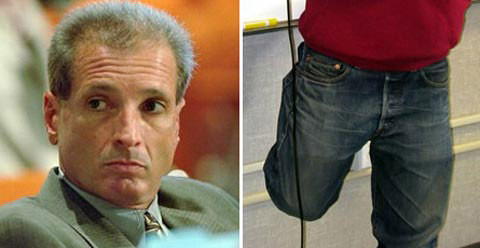 Cắt nhầm chân của bệnh nhân. Một bác sĩ ở Tampa, bang Florida (Mỹ) đã cắt cụt nhầm chân của bệnh nhân Willie King, 52 tuổi vào tháng 2/1995. Cuộc điều tra sau đó hé lộ hàng loạt sai lầm diễn ra trước ca phẫu thuật. Mặc dù giữa quá trình phẫu thuật, nhóm bác sĩ đã nhận ra họ đang phẫu thuật nhầm chân nhưng lúc đó tất cả đã quá muộn, chân của bệnh nhân đã bị cắt cụt.