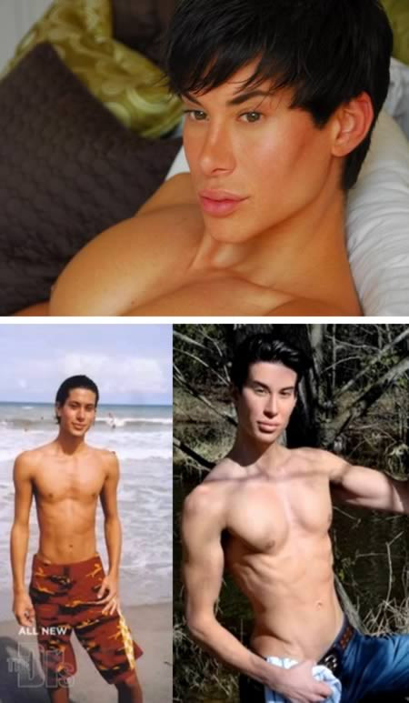 Hơn 10 năm nay, Justin Jedlica đã trải qua 90 cuộc phẫu thuật thẩm mỹ như cấy silicon vào mông, bụng, bắp tay, để biến mình thành một búp bê Ken sống.