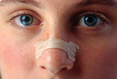 Ngáy. Khoảng chừng 10% trẻ ngáy. Có thể do nhiều lý do, như ngạt thở khi ngủ, dị ứng mùa, nghẹt mũi vì cảm, hoặc vách ngăn bị lệch. Nếu giấc ngủ của bé không bị ảnh hưởng gì thì bác sĩ nhi khoa có lẽ sẽ không chữa trị chứng ngáy này đâu. Bạn nên đưa con đến khám bác sĩ nhi khoa nếu bé không ngủ ngon giấc do ngáy hoặc bị các vấn đề về hô hấp. Nếu ngáy làm ảnh hưởng đến giấc ngủ và đó không phải là triệu chứng ngạt thở thì bác sĩ có thể cho bé sử dụng thuốc, chẳng hạn như xịt xtê-rô-ít vào mũi để làm teo nhỏ mô mũi lại.