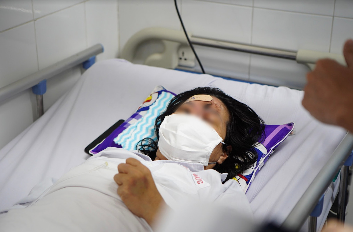 Mu mat sau khi nang mui o spa