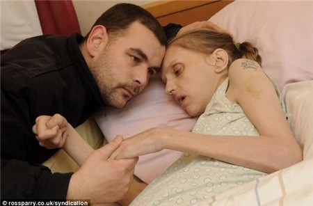 Cơ thể cô giờ đây trở nên gầy gò, xanh xao.