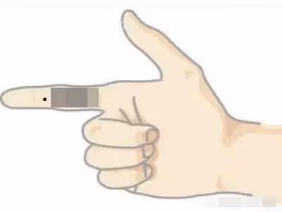 Not ruoi tren tay tuong trung cho dieu gi?-Hinh-4