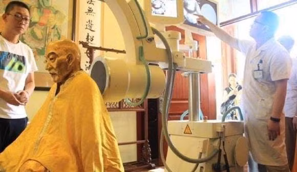 Cac chuyen gia kinh ngac sau khi chup X-quang xac nha su-Hinh-3