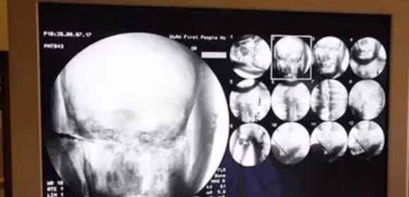 Cac chuyen gia kinh ngac sau khi chup X-quang xac nha su-Hinh-5