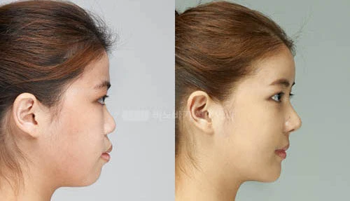 Người có 3 nét tướng này, cô đơn cả đời, nghèo mạt kiếp