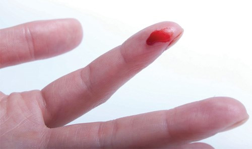 Người mắc chứng rối loạn đông máu không mất máu đến chết vì vết cắt nhỏ. Ở một số nơi, người ta cảnh báo bệnh nhân mắc chứng rối loạn đông máu không nên cầm nắm những vật sắc nhọn, kể cả gai hoa hồng cũng có thể làm họ mất máu nguy hiểm tính mạng. Tuy nhiên, những vết thương nhỏ không thực sự nguy hiểm tới vậy. Vết thương ở cơ quan nội tạng, vết bầm tím hoặc chấn thương gây chảy máu mới thực sự đáng sợ.