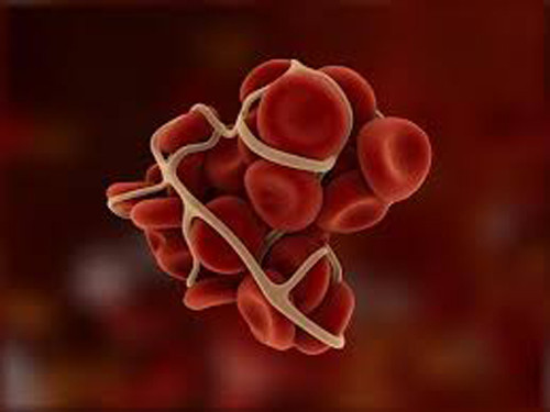 Rối loạn đông máu còn được biết đến với tên gọi Hemophilia. Bệnh tương đối hiếm gặp, tỷ lệ mắc bệnh khi sinh là 1/10.000. Mắc rối loạn đông máu, người bệnh chảy máu lâu hơn bình thường do thiếu yếu tố gây đông. Bệnh được chia làm 2 loại là Hemophilia A (thiếu yếu tố đông máu số 8) và Hemophilia B (thiếu yếu tố đông máu số 9).