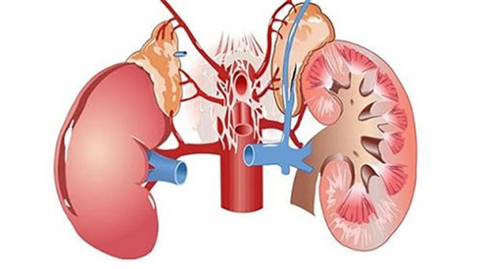 Hạt đu đủ cũng được sử dụng để điều trị bệnh thận, nó sẽ là một phương thuốc tốt ngăn ngừa suy thận.