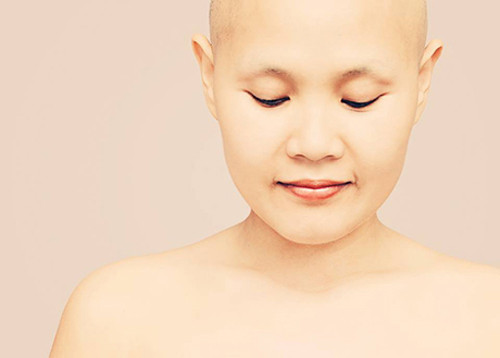Ám ảnh về thời trang. Không chỉ mệt mỏi, bệnh nhân hóa trị ung thư vú thường bị rụng tóc, giảm cân mạnh, da khô… Điều này khiến họ cảm thấy vô cùng thất vọng về bản thân, ngoại hình.