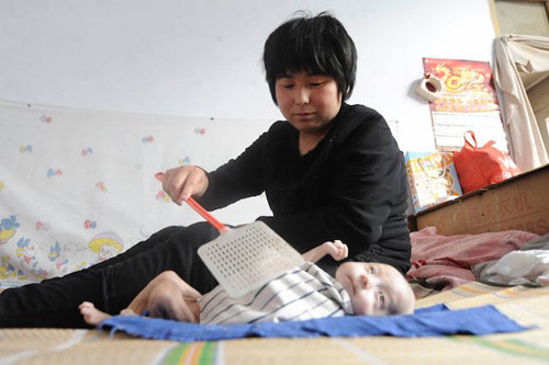 Dù mắc bệnh hiểm song Guo chưa được chạy chữa bởi hoàn cảnh khó khăn. Mẹ bé là cô Ren Minge (24 tuổi) bị tâm thần trong khi cha là Guo Hongqing (27 tuổi) không làm được việc nặng do di chứng gãy xương trong tai nạn lao động cách đây 2 năm. Ông bà nội của bé cùng sống trong một mái nhà. 5 miệng ăn chỉ trông chờ vào đồng lương 2.000 tệ (hơn 6,5 triệu đồng) của người cha.
